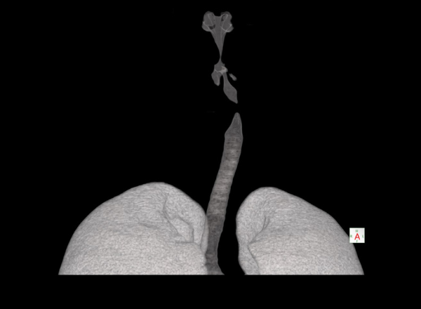 Equipo de tomografía helicoidal en Lima – Centro de Imágenes Médicas CIM