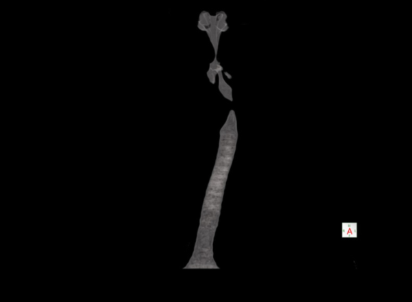 Sala de tomografía en San Juan de Miraflores – diagnóstico especializado