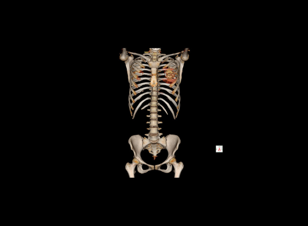 Tomografía computarizada de abdomen y pelvis – Lima Sur