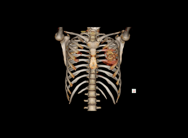 Equipo moderno para tomografía de cráneo en CIM San Juan de Miraflores