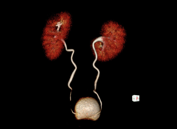 Tomografía de columna y tórax en Lima – clínica CIM