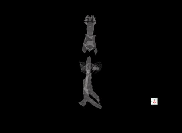 Sala de mamografía digital en San Juan de Miraflores – prevención cáncer de mama