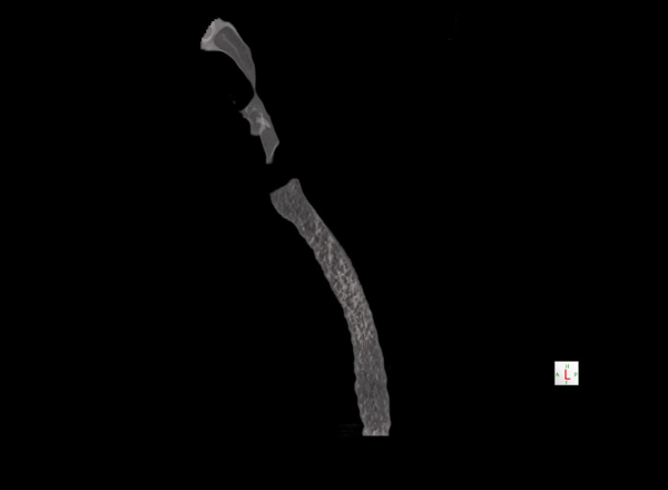 Ecografía Doppler abdominal en Lima – diagnóstico vascular